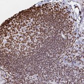 Anti-LMNB1 antibody produced in rabbit Prestige Antibodies&#174; Powered by Atlas Antibodies, affinity isolated antibody, buffered aqueous glycerol solution