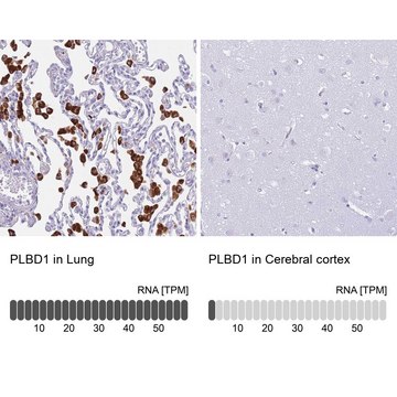 Anti-PLBD1 antibody produced in rabbit Prestige Antibodies&#174; Powered by Atlas Antibodies, affinity isolated antibody, buffered aqueous glycerol solution