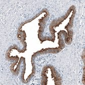 Anti-TMPRSS2 antibody produced in mouse Prestige Antibodies&#174; Powered by Atlas Antibodies, clone CL12511, purified by using Protein A, buffered aqueous glycerol solution