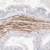 Anti-KCNH5 antibody produced in rabbit Prestige Antibodies&#174; Powered by Atlas Antibodies, affinity isolated antibody, buffered aqueous glycerol solution