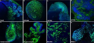 3dGRO&#174; Lung Organoid Maturation Medium Serum-free ready-to-use media used to differentiate lung bud organoids (LBOs) into mature branching lung organoids.