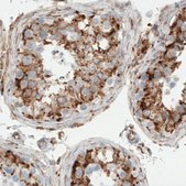Monoclonal Anti-MTDH antibody produced in mouse Prestige Antibodies&#174; Powered by Atlas Antibodies, clone CL0401, purified immunoglobulin, buffered aqueous glycerol solution