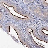 Anti-SLC9A3 antibody produced in rabbit Prestige Antibodies&#174; Powered by Atlas Antibodies, affinity isolated antibody, buffered aqueous glycerol solution