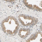 Anti-IER3IP1 antibody produced in rabbit Prestige Antibodies&#174; Powered by Atlas Antibodies, affinity isolated antibody, buffered aqueous glycerol solution