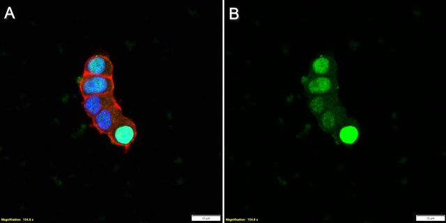 Anti-AUTS2 Antibody, clone 1D8 ZooMAb&#174; Rabbit Monoclonal recombinant, expressed in HEK 293 cells