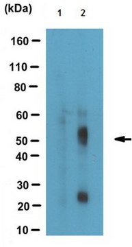 Anti-phospho Tau (Thr181), clone 1E7 Antibody clone 1E7, from mouse, purified by affinity chromatography