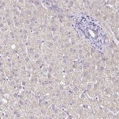 Anti-GABBR2 antibody produced in rabbit Prestige Antibodies&#174; Powered by Atlas Antibodies, affinity isolated antibody, buffered aqueous glycerol solution