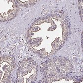 Anti-ANXA5 antibody produced in rabbit Prestige Antibodies&#174; Powered by Atlas Antibodies, affinity isolated antibody, buffered aqueous glycerol solution