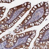 Anti-IL7 antibody produced in rabbit Prestige Antibodies&#174; Powered by Atlas Antibodies, affinity isolated antibody, buffered aqueous glycerol solution