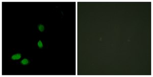 Anti-HMG17 antibody produced in rabbit affinity isolated antibody