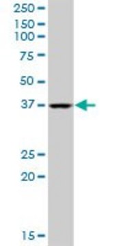 Anti-QTRT1 antibody produced in mouse purified immunoglobulin, buffered aqueous solution