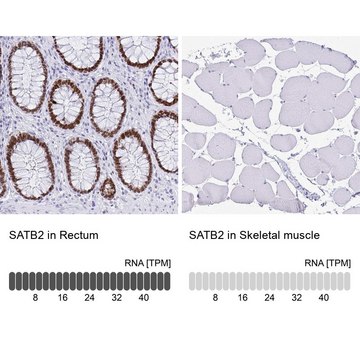 Monoclonal Anti-SATB2 antibody produced in mouse Prestige Antibodies&#174; Powered by Atlas Antibodies, clone CL0276, purified immunoglobulin, buffered aqueous glycerol solution