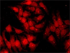Anti-Chk1 antibody, Mouse monoclonal ~2&#160;mg/mL, clone DCS-310, purified from hybridoma cell culture