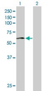 Anti-PHACS antibody produced in mouse purified immunoglobulin, buffered aqueous solution