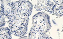 Anti-Laminin &#946;1 Antibody, clone 4E10 ZooMAb&#174; Mouse Monoclonal recombinant, expressed in HEK 293 cells