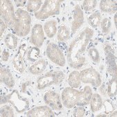 Anti-ATP2B1 antibody produced in rabbit Prestige Antibodies&#174; Powered by Atlas Antibodies, affinity isolated antibody, buffered aqueous glycerol solution