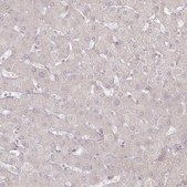 Anti-ARSB antibody produced in rabbit Prestige Antibodies&#174; Powered by Atlas Antibodies, affinity isolated antibody, buffered aqueous glycerol solution