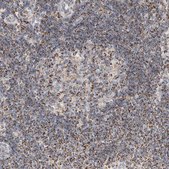 Anti-C1QBP antibody produced in rabbit Prestige Antibodies&#174; Powered by Atlas Antibodies, affinity isolated antibody, buffered aqueous glycerol solution