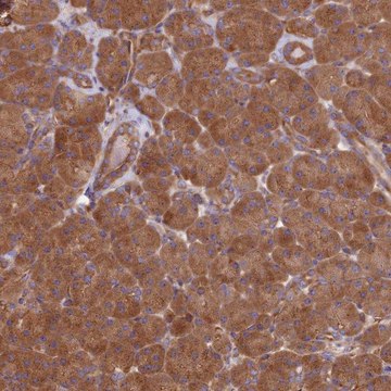 Anti-DCTN3 antibody produced in rabbit Prestige Antibodies&#174; Powered by Atlas Antibodies, affinity isolated antibody, buffered aqueous glycerol solution