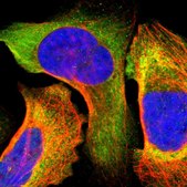 ANTI-IRF9 antibody produced in rabbit Ab2, Prestige Antibodies&#174; Powered by Atlas Antibodies, affinity isolated antibody, buffered aqueous glycerol solution