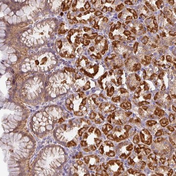 Anti-STK35 antibody produced in rabbit Prestige Antibodies&#174; Powered by Atlas Antibodies, affinity isolated antibody, buffered aqueous glycerol solution