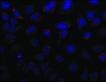 Anti-MR&#8722;Pro ADM antibody produced in rabbit