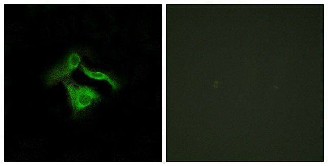 Anti-GPR149 antibody produced in rabbit affinity isolated antibody