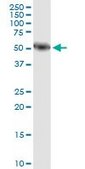 Monoclonal Anti-AMY1A antibody produced in mouse clone 2D4, purified immunoglobulin, buffered aqueous solution