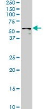 Monoclonal Anti-STK33 antibody produced in mouse clone 4F7, purified immunoglobulin, buffered aqueous solution