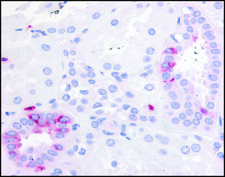 Anti-PTGER2 (AB1) antibody produced in rabbit affinity isolated antibody, buffered aqueous solution