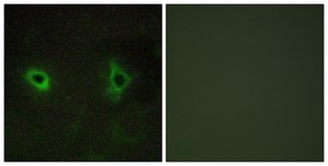Anti-Collagen IV &#945;3 antibody produced in rabbit affinity isolated antibody