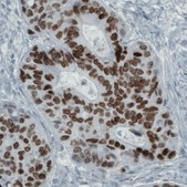 Monoclonal Anti-SATB2 antibody produced in mouse Prestige Antibodies&#174; Powered by Atlas Antibodies, clone CL0323, purified immunoglobulin, buffered aqueous glycerol solution