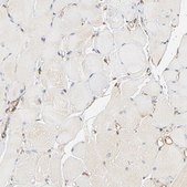 Anti-BCAP31 antibody produced in rabbit Prestige Antibodies&#174; Powered by Atlas Antibodies, affinity isolated antibody, buffered aqueous glycerol solution