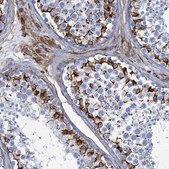 Anti-PGM2 antibody produced in rabbit Prestige Antibodies&#174; Powered by Atlas Antibodies, affinity isolated antibody, buffered aqueous glycerol solution