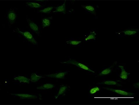Anti-NFAT5 antibody produced in mouse purified immunoglobulin, buffered aqueous solution
