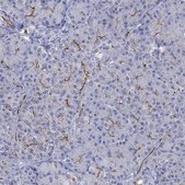 Anti-CFTR antibody produced in rabbit Prestige Antibodies&#174; Powered by Atlas Antibodies, affinity isolated antibody, buffered aqueous glycerol solution