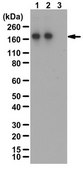 Anti-phospho TIE2/TEK Antibody (Tyr992) 0.25&#160;mg/mL, from rabbit