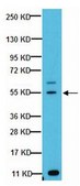 Anti-GLUT-4 Antibody, C-terminus from rabbit, purified by affinity chromatography