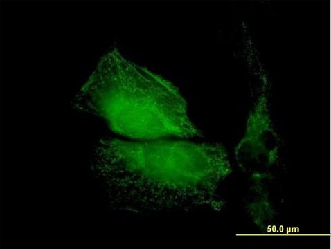 Anti-TMOD1 antibody produced in mouse purified immunoglobulin, buffered aqueous solution