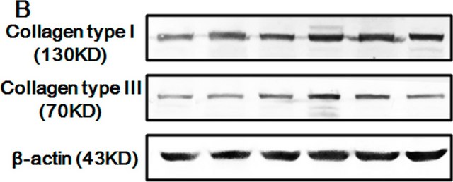 Monoclonal Anti-Collagen, Type III antibody produced in mouse clone FH-7A, ascites fluid