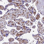 Anti-TRPV2 antibody produced in rabbit Prestige Antibodies&#174; Powered by Atlas Antibodies, affinity isolated antibody, buffered aqueous glycerol solution