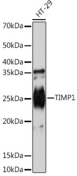 Anti-TIMP1 Antibody, clone 5O7P1, Rabbit Monoclonal