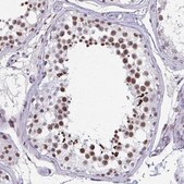 Anti-CBFA2T2 antibody produced in rabbit Prestige Antibodies&#174; Powered by Atlas Antibodies, affinity isolated antibody, buffered aqueous glycerol solution
