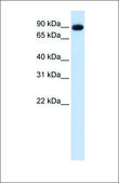 Anti-POSTN antibody produced in rabbit affinity isolated antibody