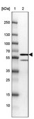 Anti-SNX8 antibody produced in rabbit Prestige Antibodies&#174; Powered by Atlas Antibodies, affinity isolated antibody, buffered aqueous glycerol solution