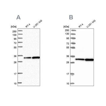 Anti-TBCB antibody produced in rabbit Prestige Antibodies&#174; Powered by Atlas Antibodies, affinity isolated antibody, buffered aqueous glycerol solution