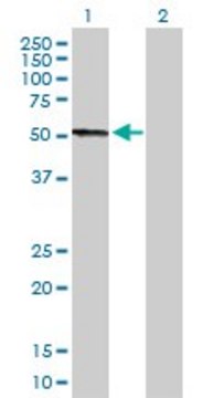 Anti-CPB2 antibody produced in rabbit purified immunoglobulin, buffered aqueous solution