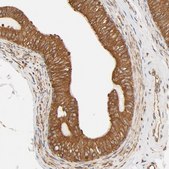 Anti-BCAP31 antibody produced in rabbit Prestige Antibodies&#174; Powered by Atlas Antibodies, affinity isolated antibody, buffered aqueous glycerol solution