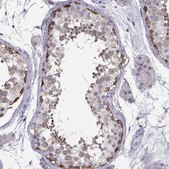 Anti-TSPYL5 antibody produced in rabbit Prestige Antibodies&#174; Powered by Atlas Antibodies, affinity isolated antibody, buffered aqueous glycerol solution