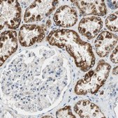 Anti-ALDH4A1 antibody produced in rabbit Prestige Antibodies&#174; Powered by Atlas Antibodies, affinity isolated antibody, buffered aqueous glycerol solution